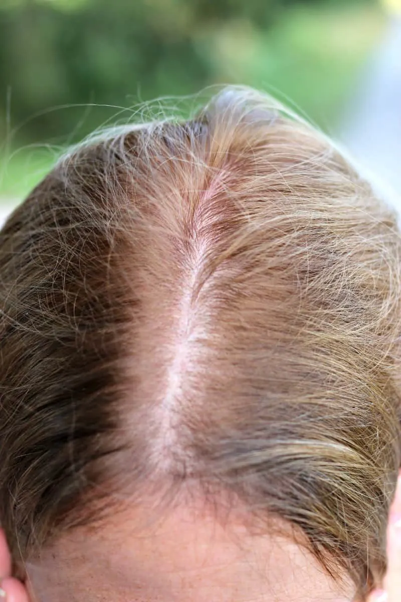 Women’s ROGAINE® Foam for Hereditary Hair Loss